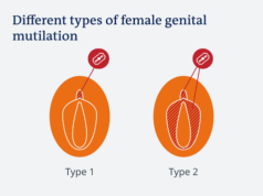 International Day of Zero Tolerance for FGM: UNFPA, CCPRH, CSOs Lend Voices to FGM Survivors