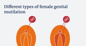 International Day of Zero Tolerance for FGM: UNFPA, CCPRH, CSOs Lend Voices to FGM Survivors