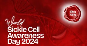 Sickle cell: Ogundoyin donates N5million to patients treatment
