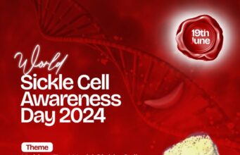 2024 Int’l sickle cell day: Ogundoyin to empower patients in memory of late father