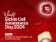 Sickle cell: Ogundoyin donates N5million to patients treatment
