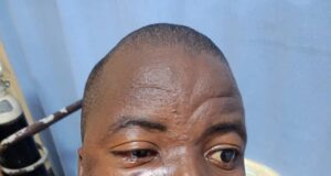 OYRTMA officers attacked by tricycle riders in Ibadan, seven suspects arrested, arraigned