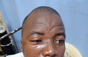 OYRTMA officers attacked by tricycle riders in Ibadan, seven suspects arrested, arraigned