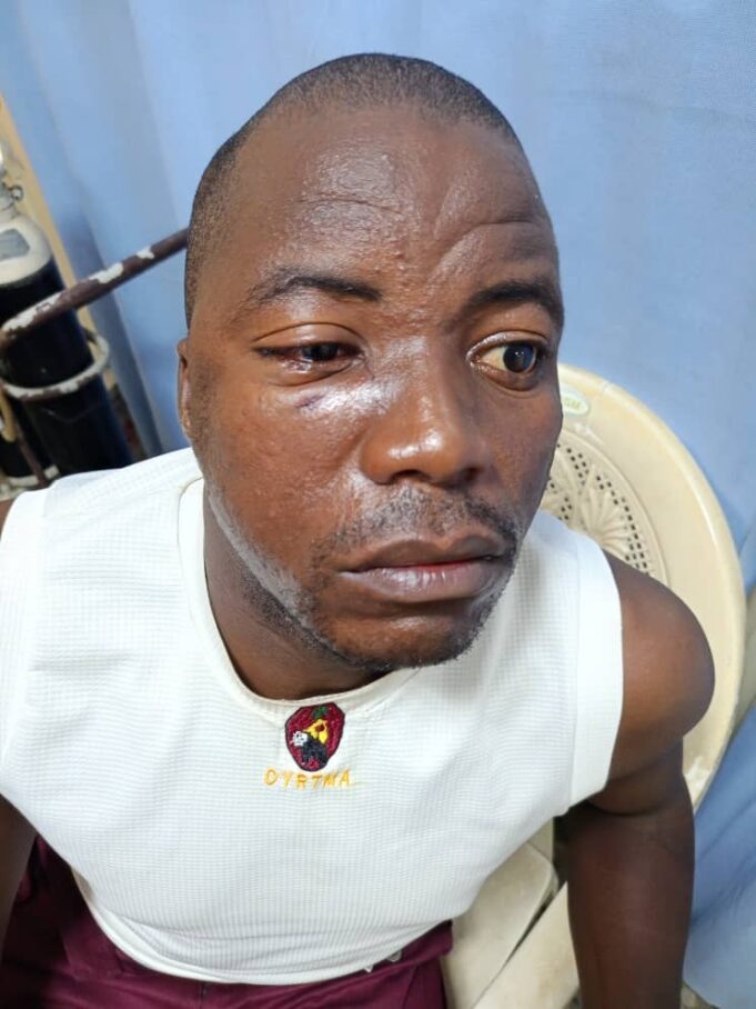 OYRTMA officers attacked by tricycle riders in Ibadan, seven suspects arrested, arraigned